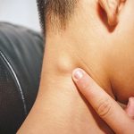 Benjolan Getah Bening Dengan Pengobatan Teknologi PET-CT