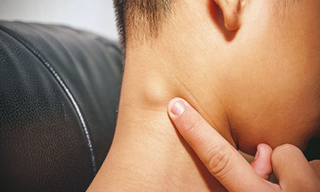 Benjolan Getah Bening Dengan Pengobatan Teknologi PET-CT