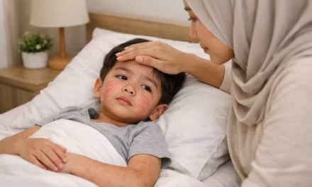 Paparan Campak Di Temukan Di Tempat Umum Carolina Selatan