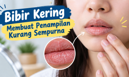 Bibir Kering Membuat Penampilan Kurang Sempurna