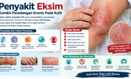 Penyakit Eksim Kondisi Peradangan Kronis Pada Kulit